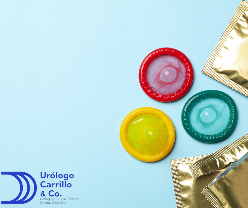 El preservativo es económico, accesible y seguro