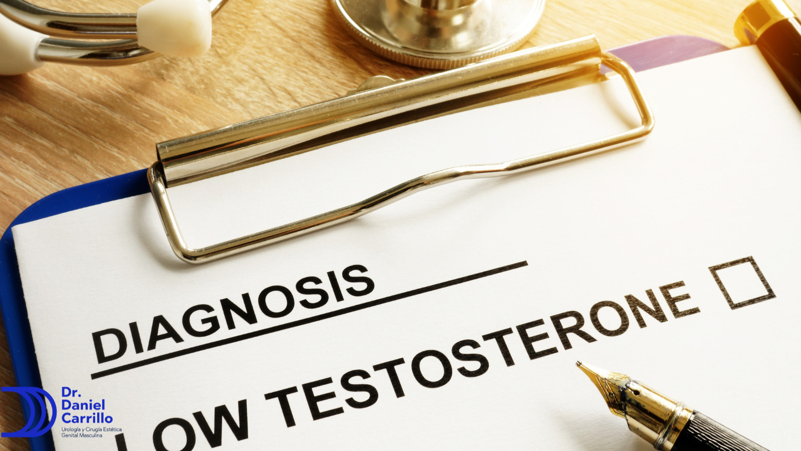 El varicocele puede causar testosterona baja 