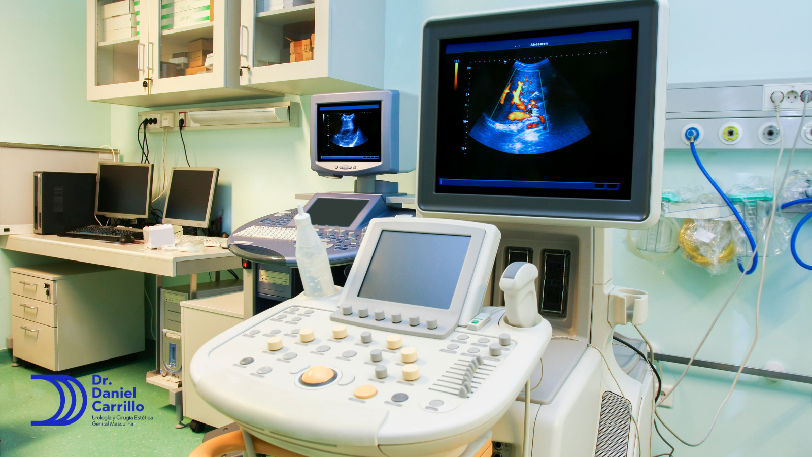 El ultrasonido doppler testicular es excelente herramienta diagnóstica