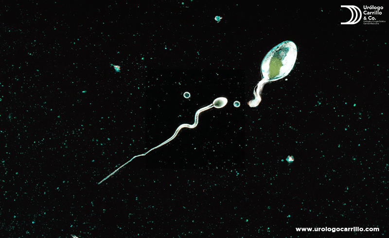 Los espermatozoides son absorbidos por el cuerpo tras la vasectomía