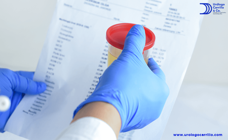 Un examen de pH ayuda al médico para su tratamiento