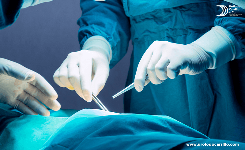 La circuncisión es una solución posible para la balanitis